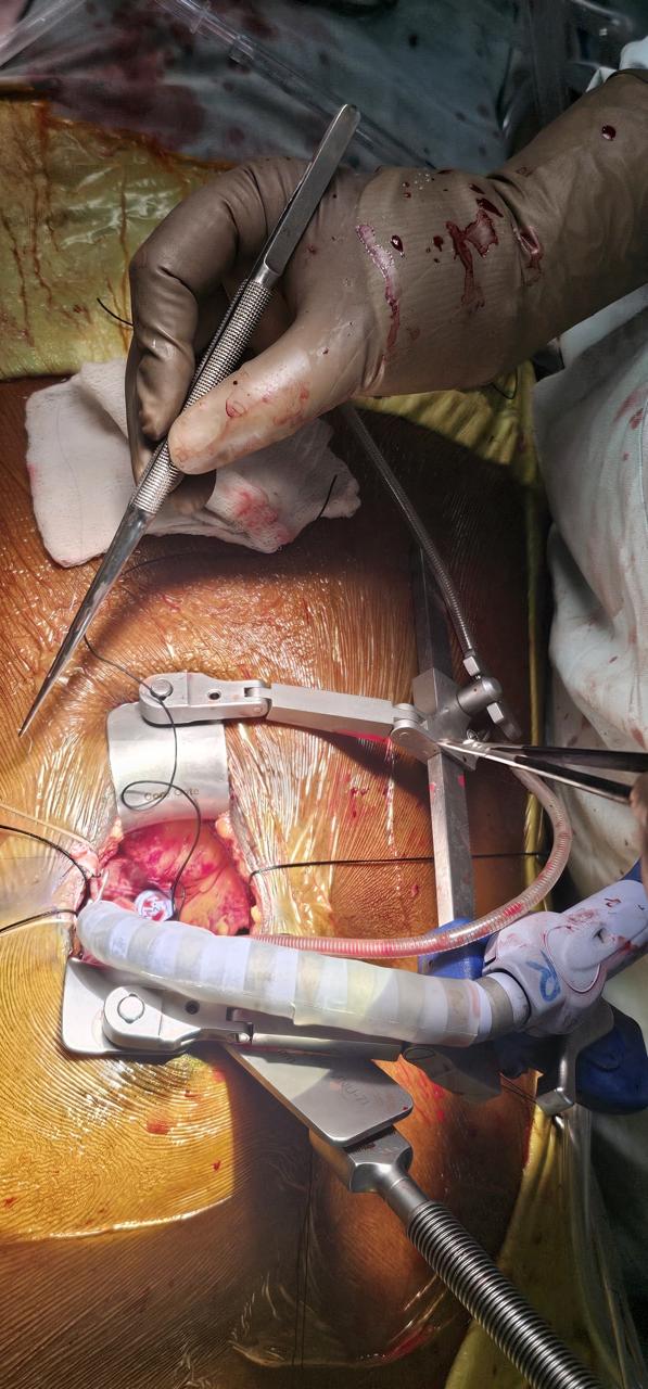 Surgery Image 2