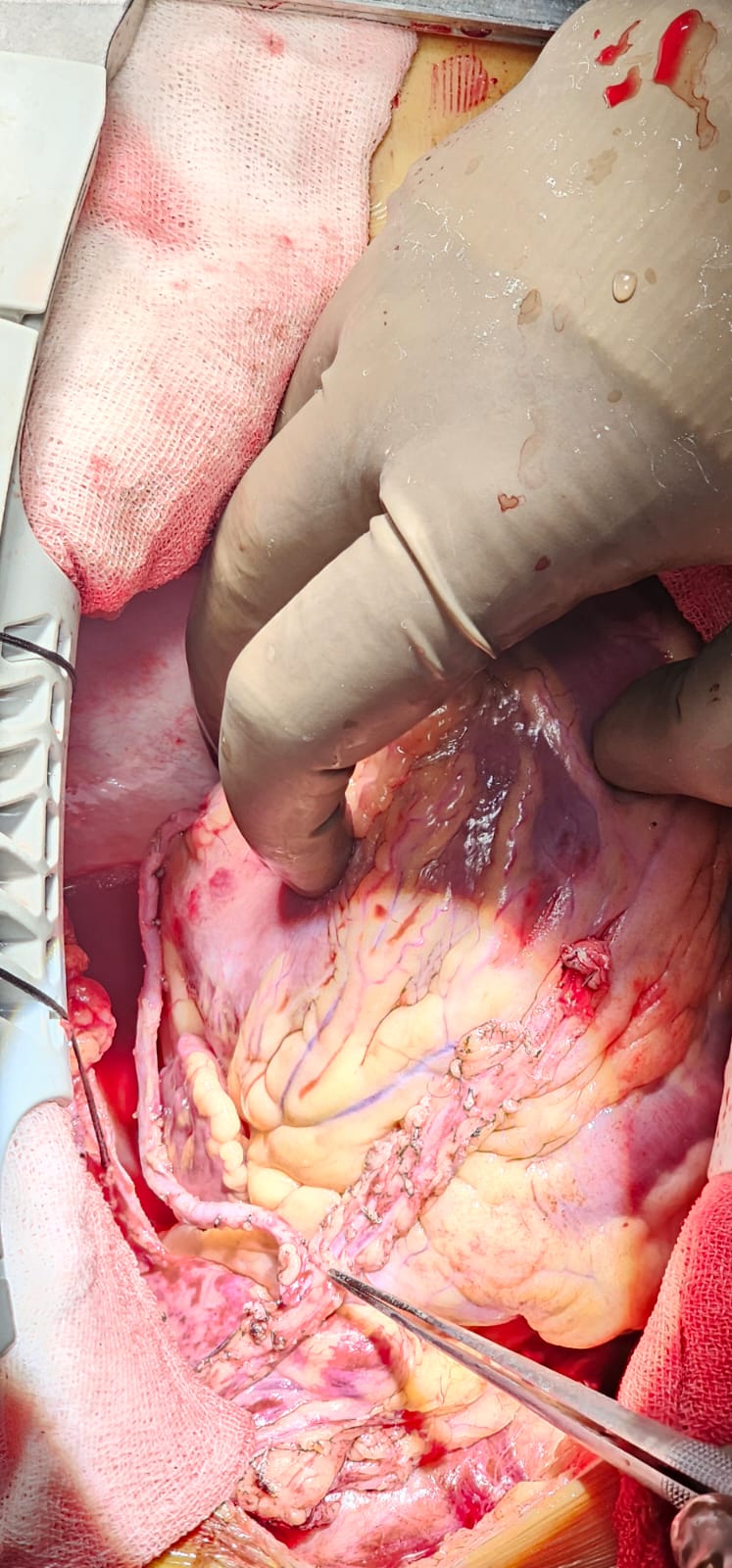 Surgery Image 9