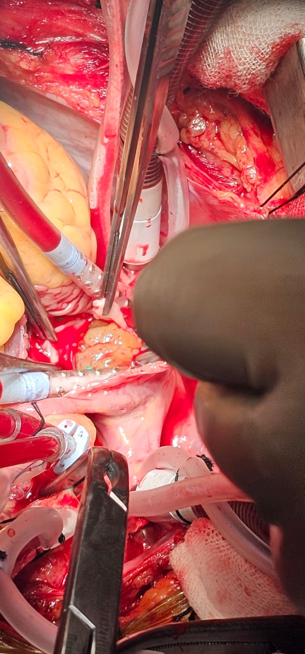 Surgery Image 8