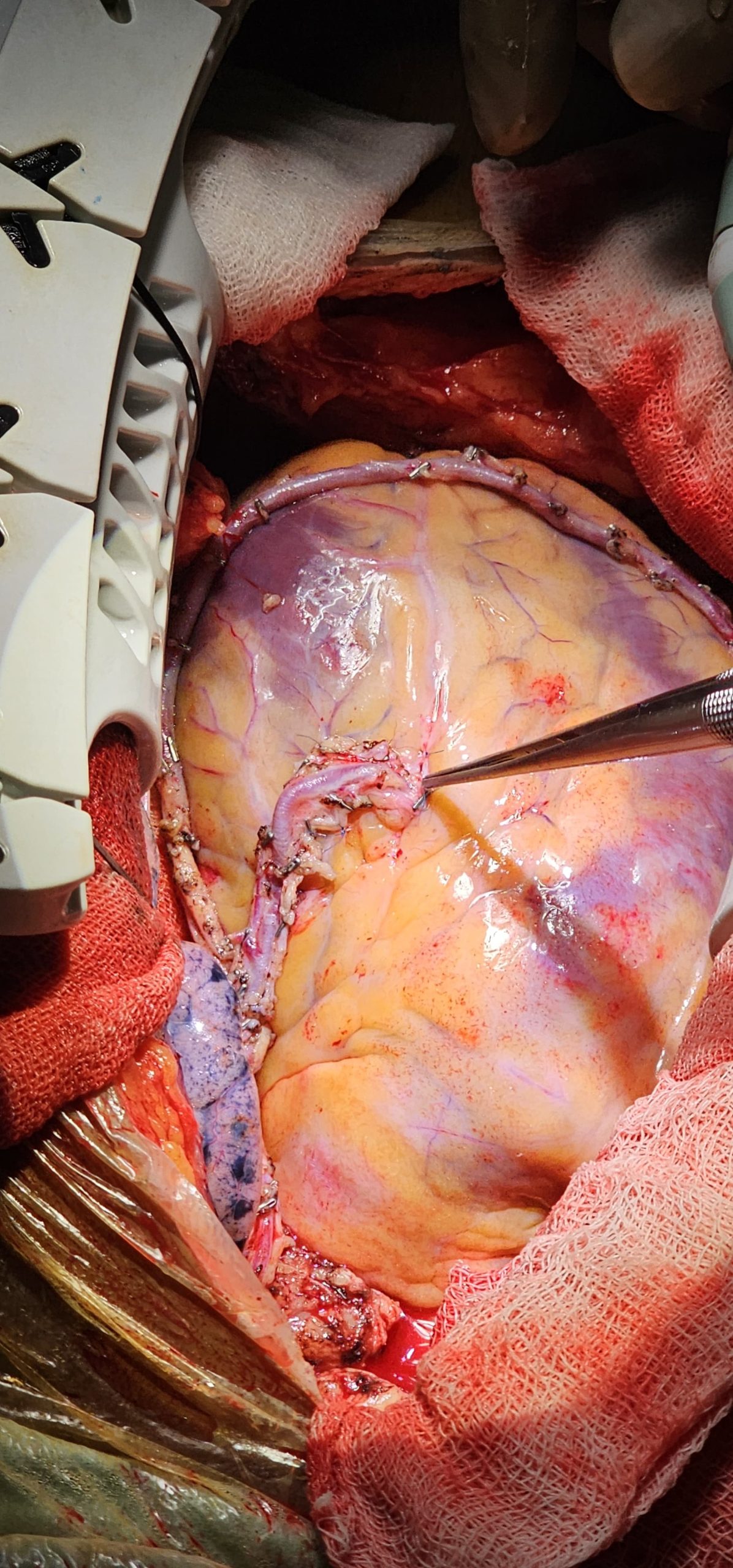 Surgery Image 7