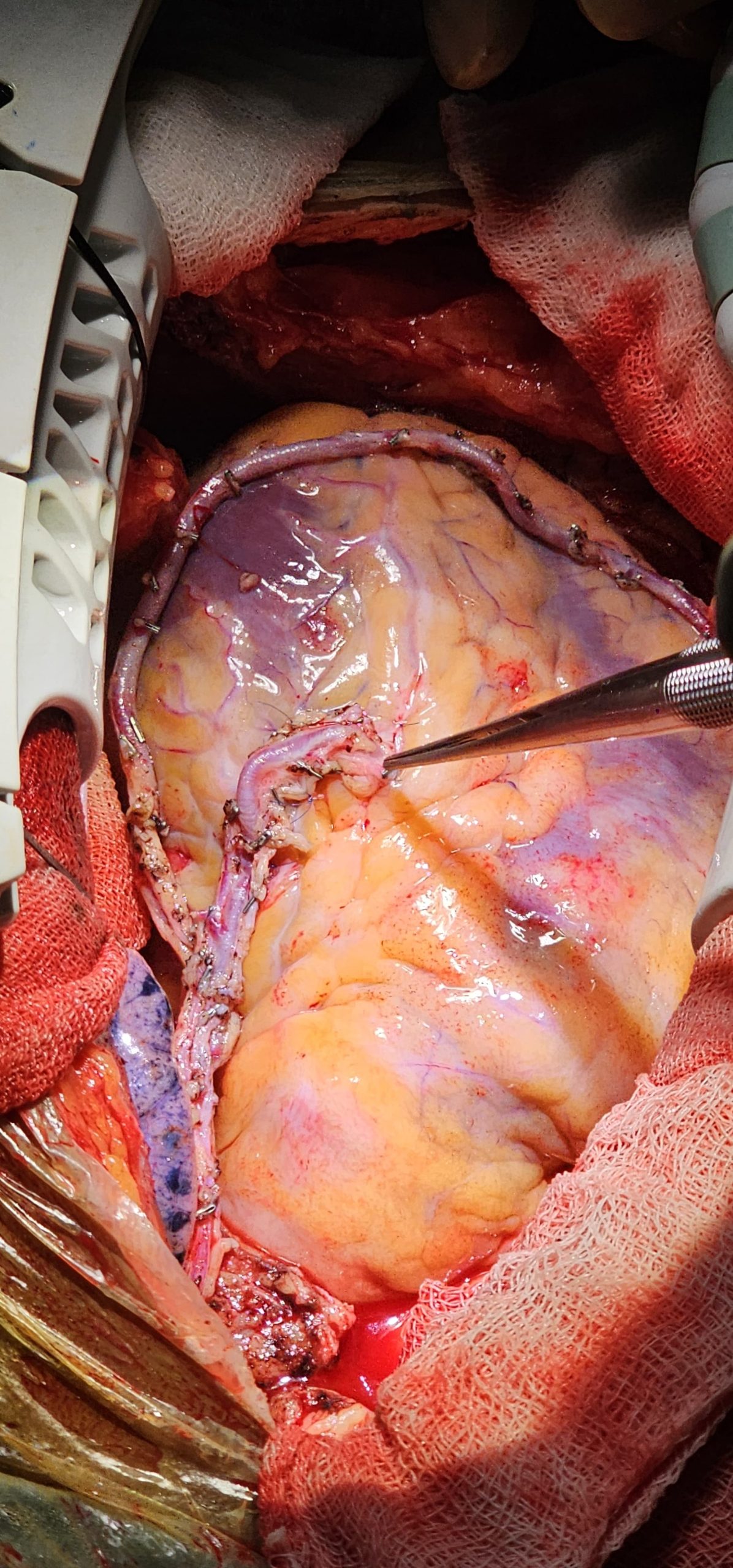 Surgery Image 6