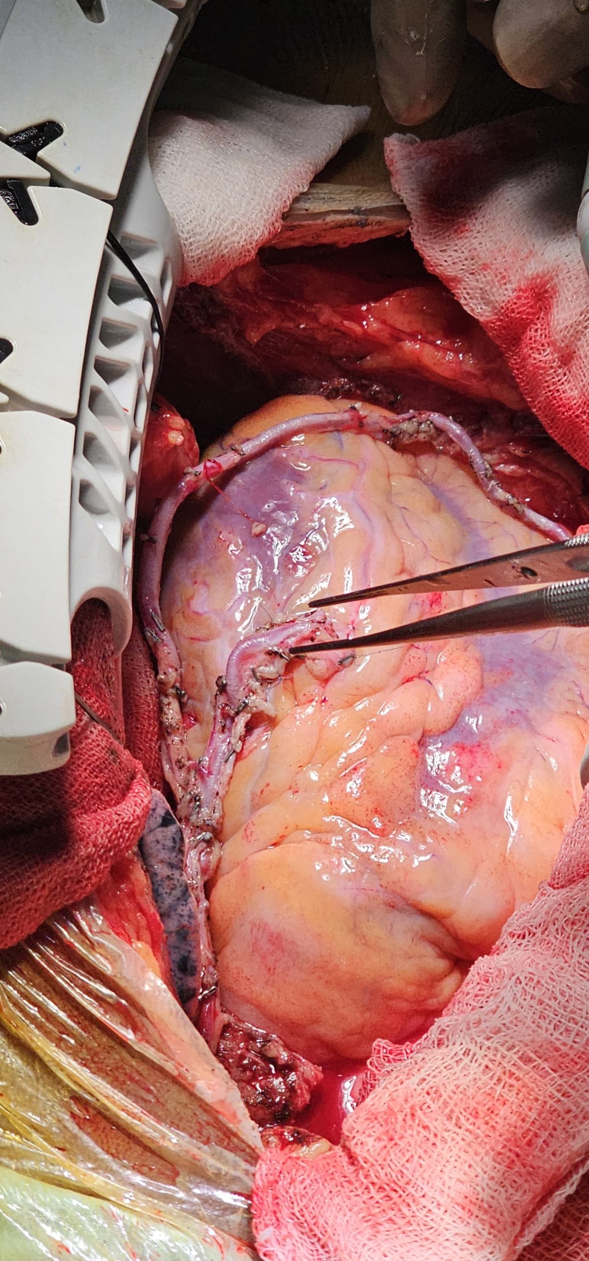 Surgery Image 5