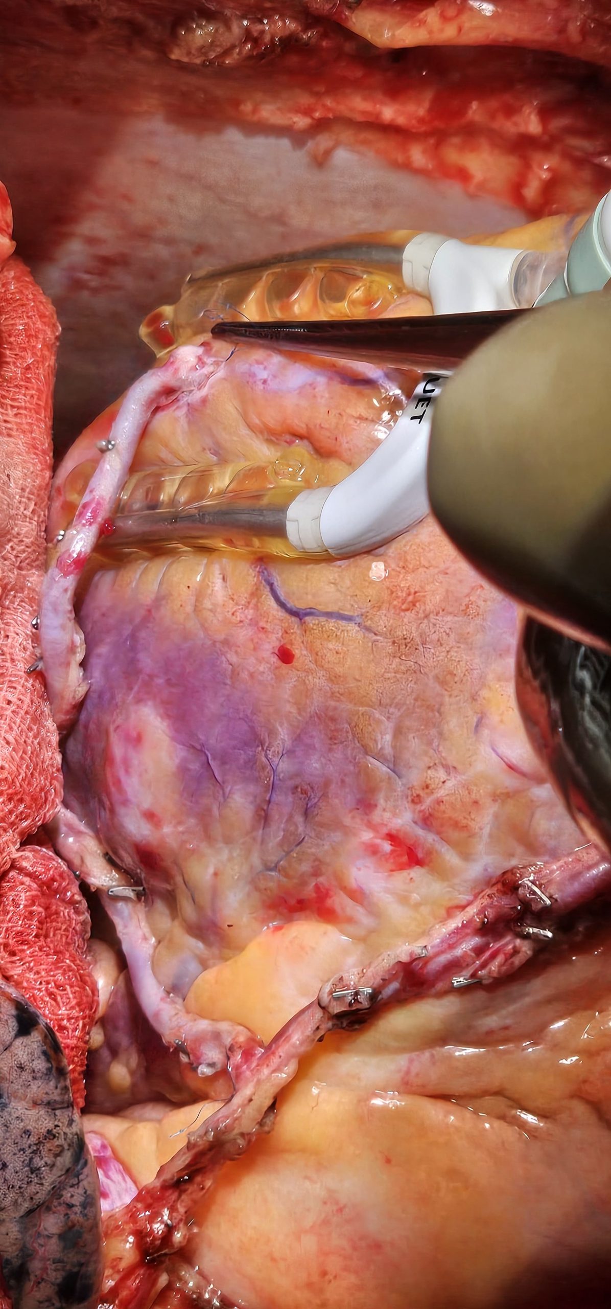 Surgery Image 4