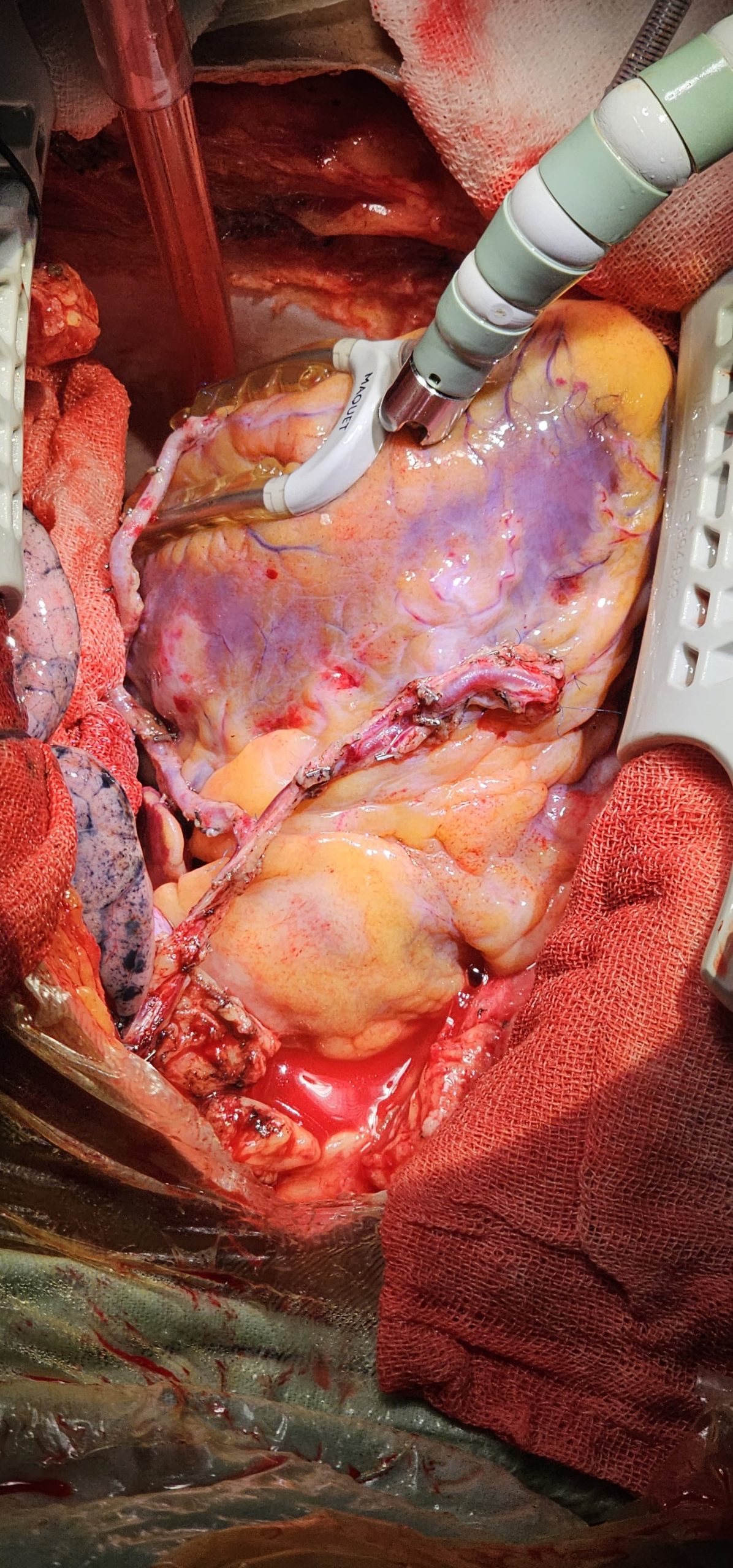 Surgery Image 3
